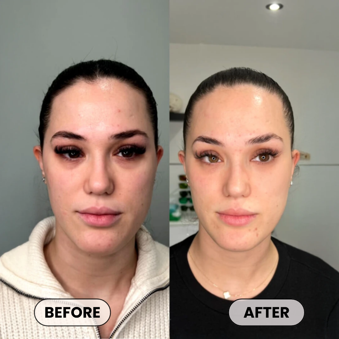 Plumper, Younger-Looking Skin in 14 Days or Less