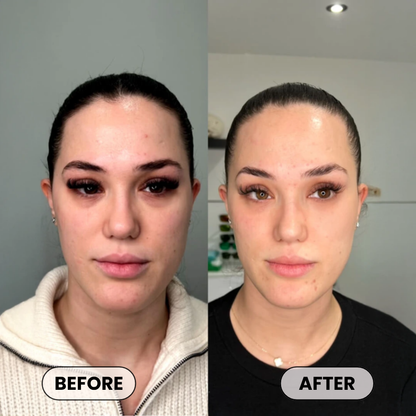 Plumper, Younger-Looking Skin in 14 Days or Less