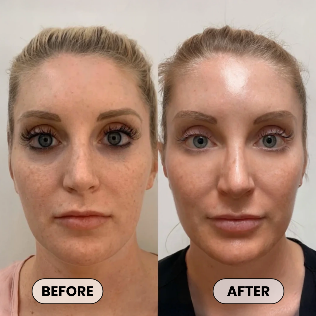 Plumper, Younger-Looking Skin in 14 Days or Less