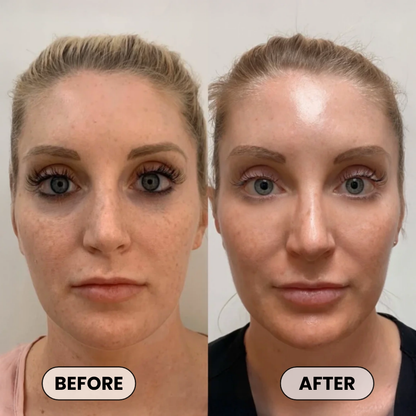 Plumper, Younger-Looking Skin in 14 Days or Less