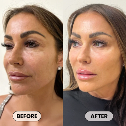 Plumper, Younger-Looking Skin in 14 Days or Less