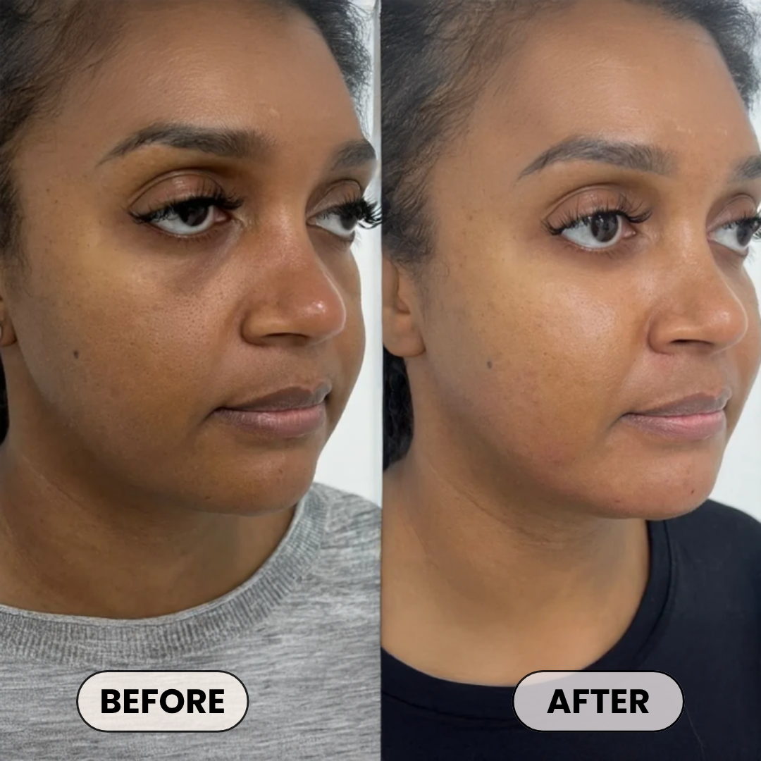 Plumper, Younger-Looking Skin in 14 Days or Less